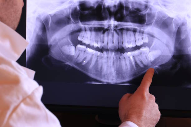 Best Pediatric Emergency Dentist in Hill City, KS