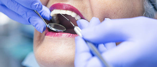 Best Emergency Tooth Extraction in Hill City, KS